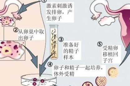 烟台毓璜顶医院试管婴儿移植后孕酮低怎么办？为什么会出现这种情况？